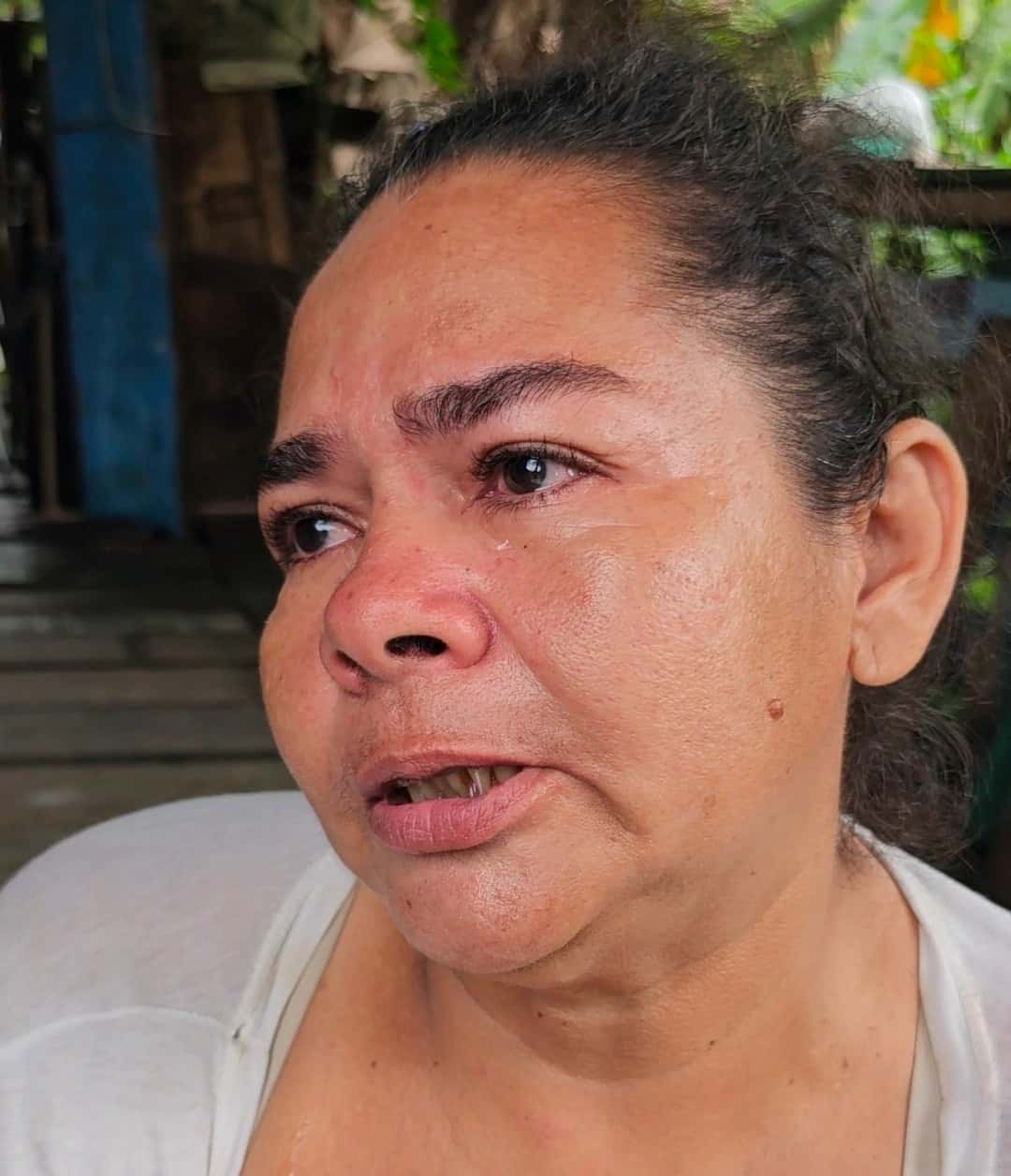 Aos 46 anos, Dona Aurilene se arrasta na lama pra sair de casa: paralisia infantil, mae enterrada ha pouco, e um barraco que esta caindo em cima dela