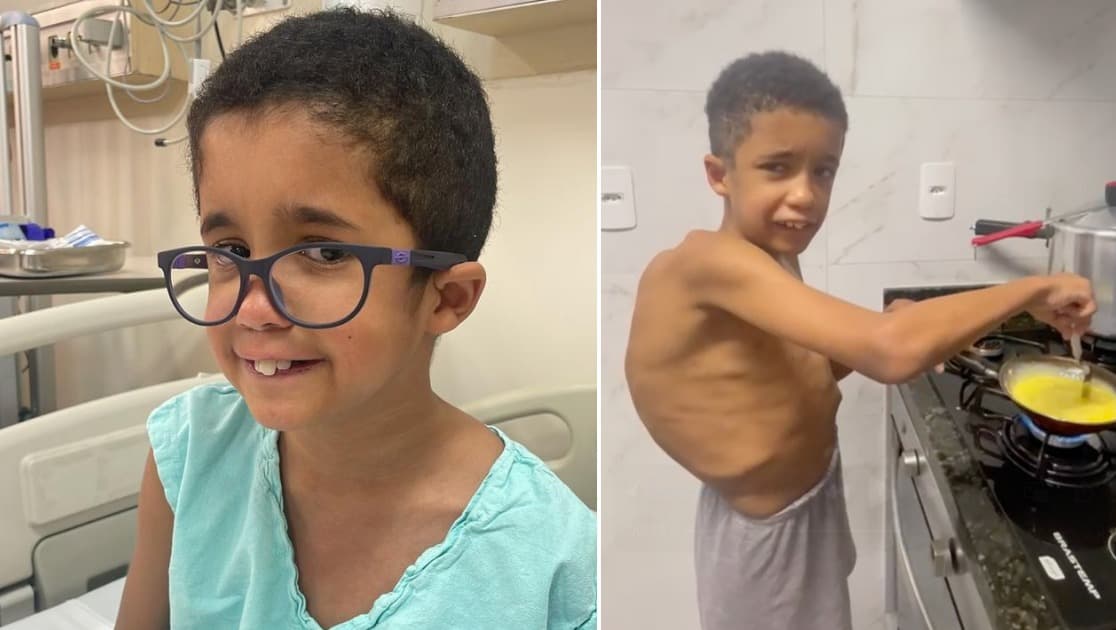 Davi tem 12 anos, e autista e a escoliose ja esta comprimindo o pulmao e o coracao dele — precisa de cirurgia urgente