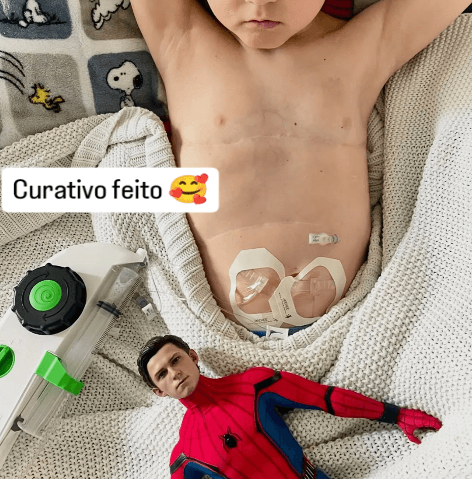 Foto atualização - Curativo feito